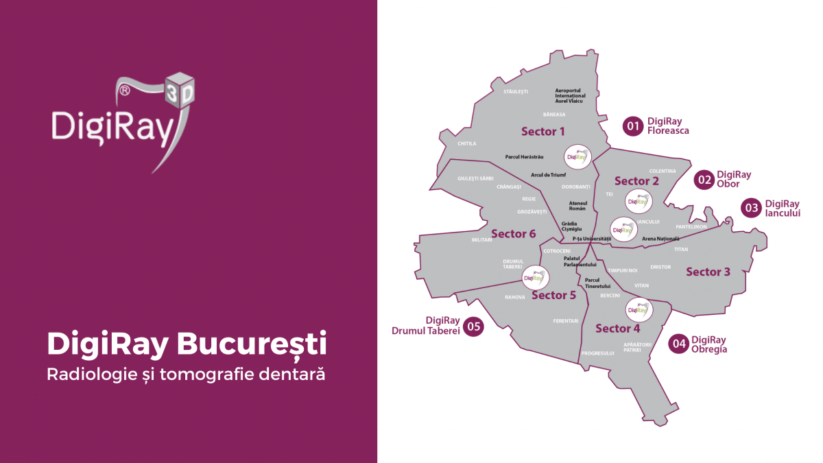 radiografii dentare DigiRay București