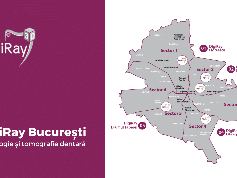 radiografii dentare DigiRay București