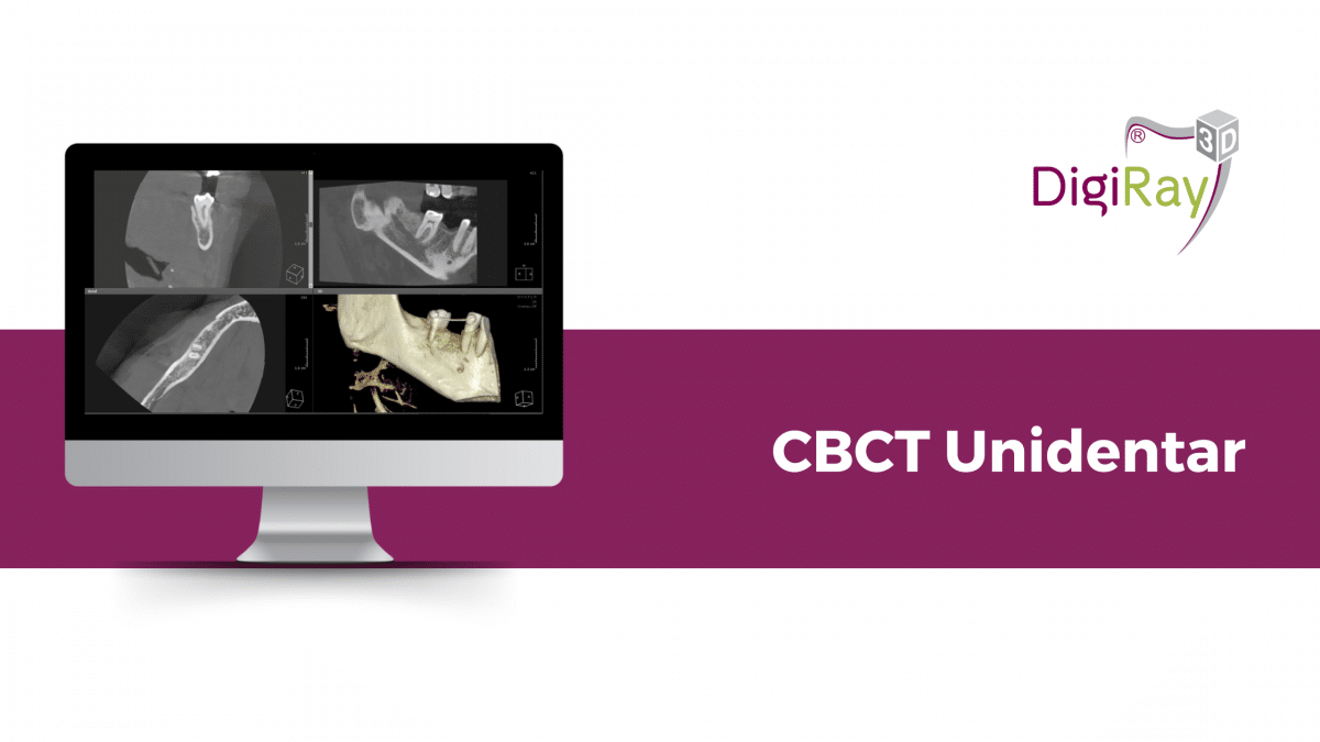 CBCT Unidentar la DigiRay