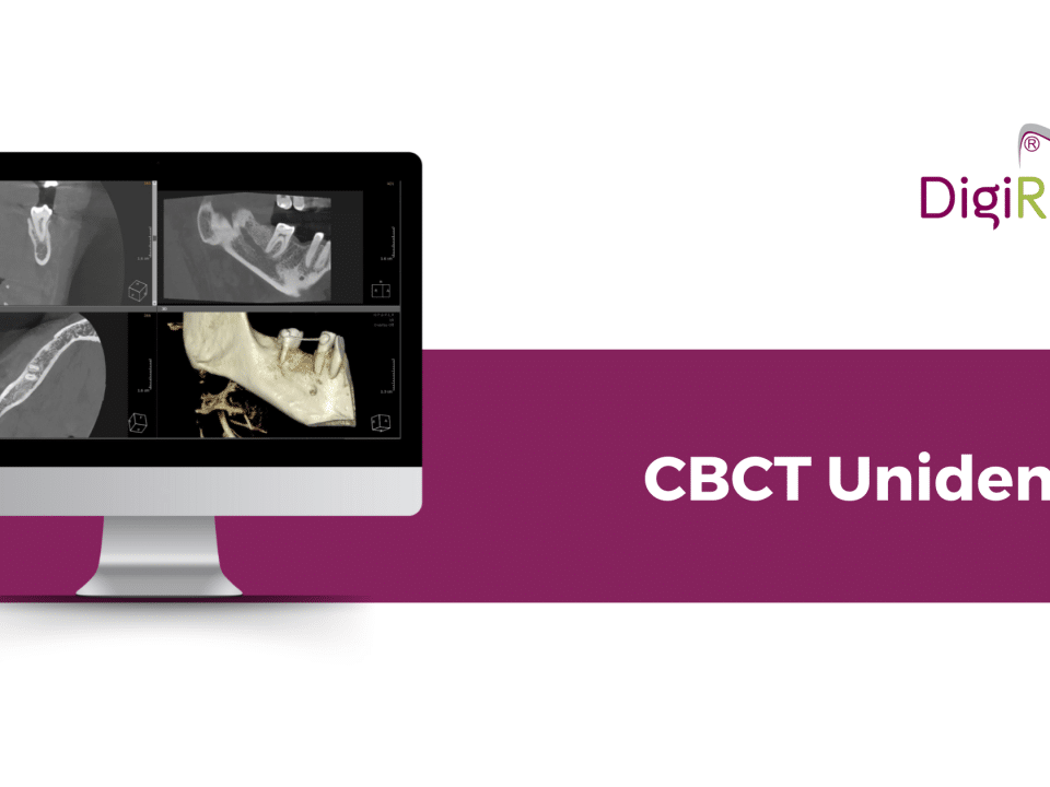 CBCT Unidentar la DigiRay