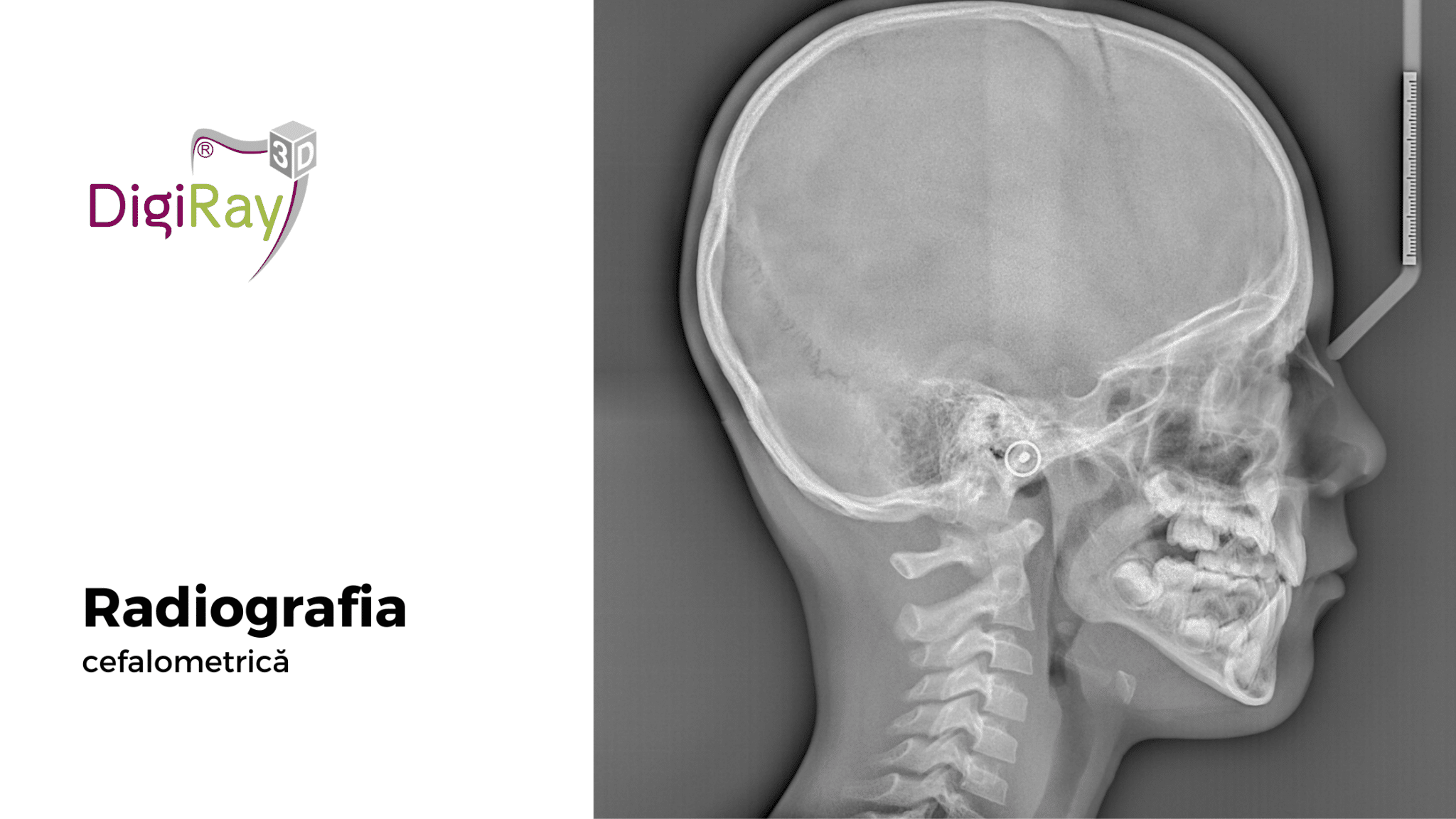 radiografia cefalometrică la DigiRay