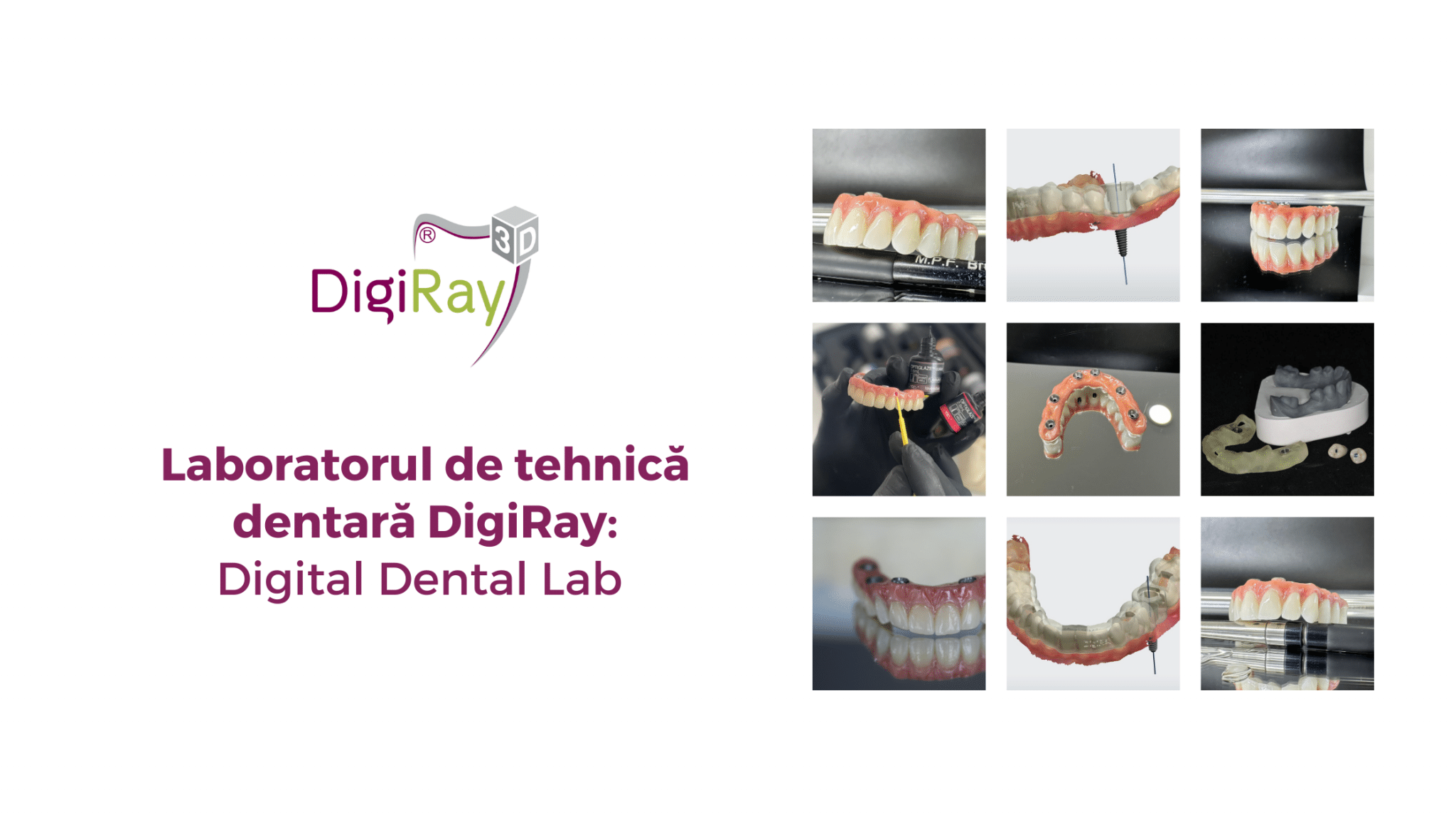 Laborator de tehnică dentară DigiRay