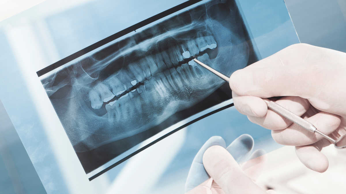 radiografii dentare la DigiRay