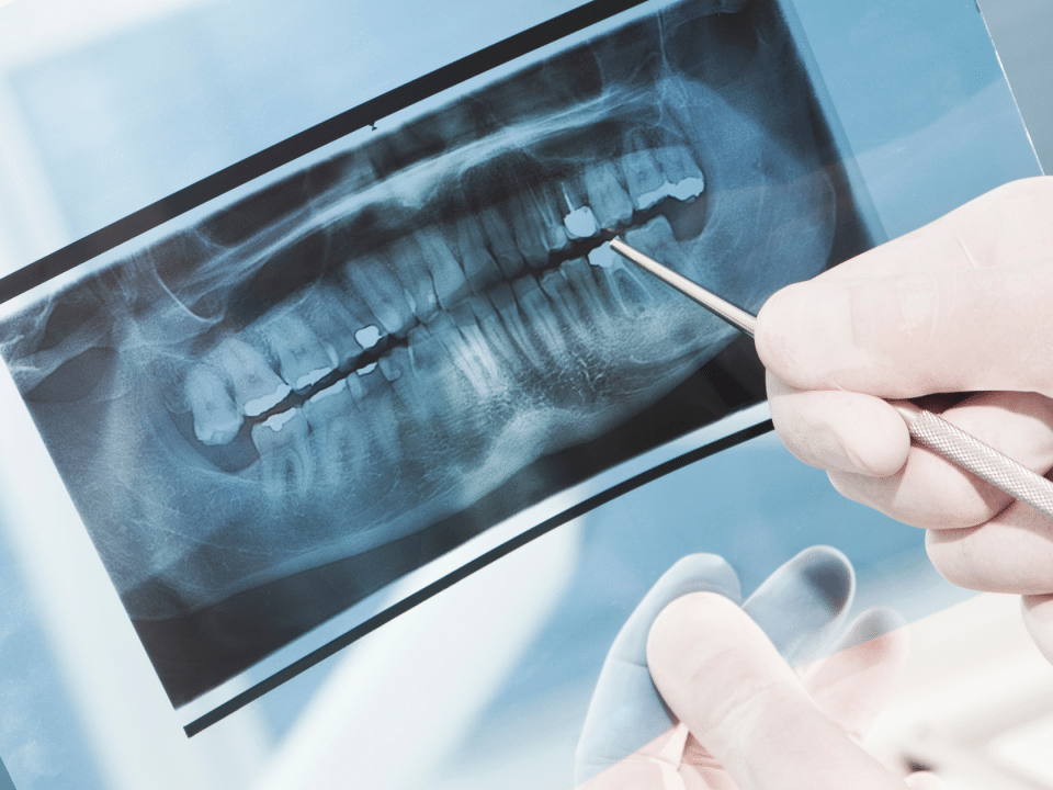 radiografii dentare la DigiRay