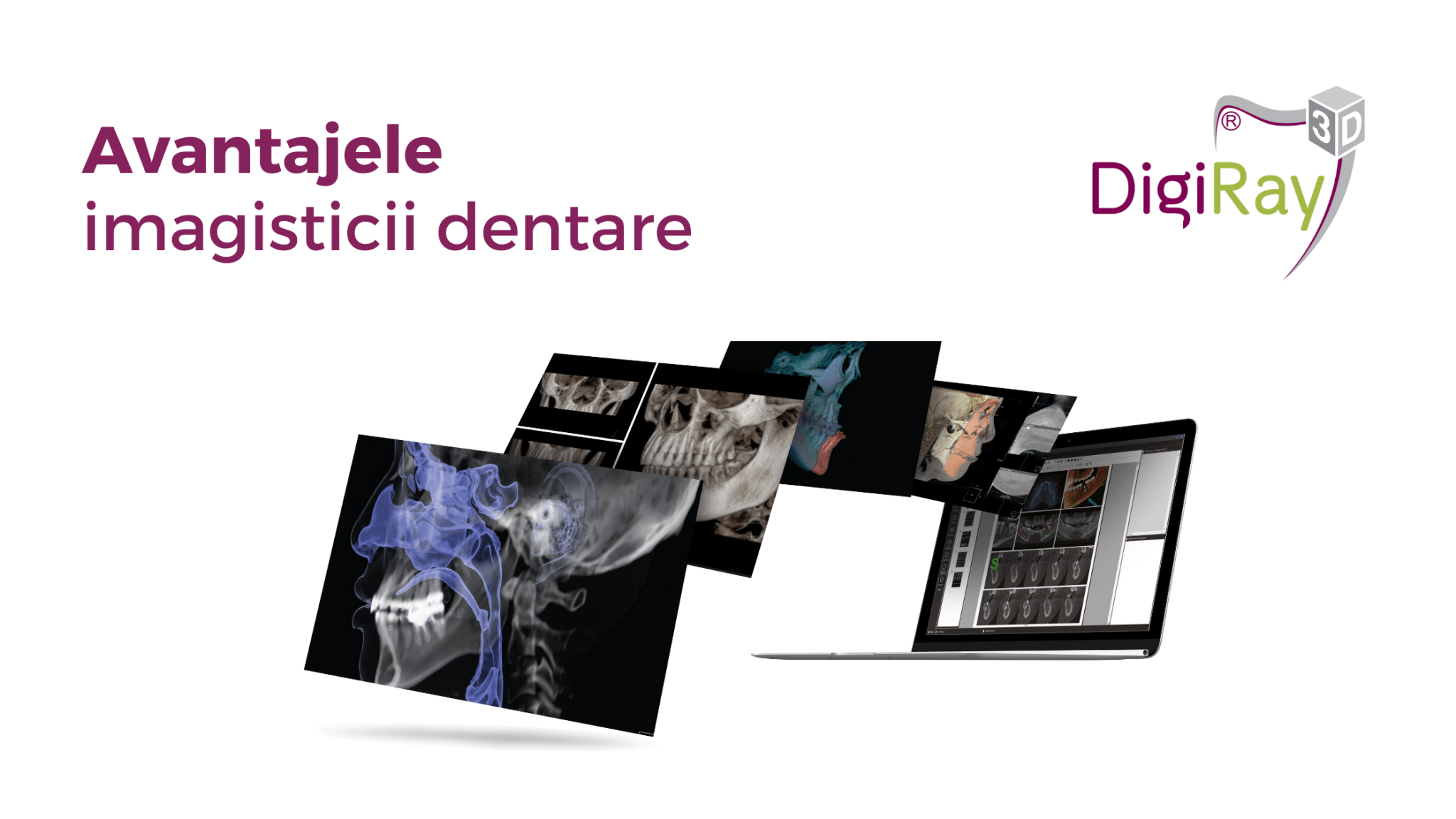 imagistică dentară la DigiRay
