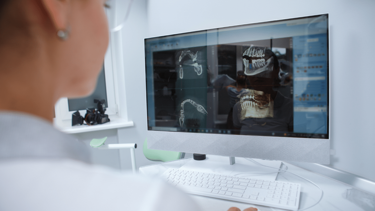 CBCT