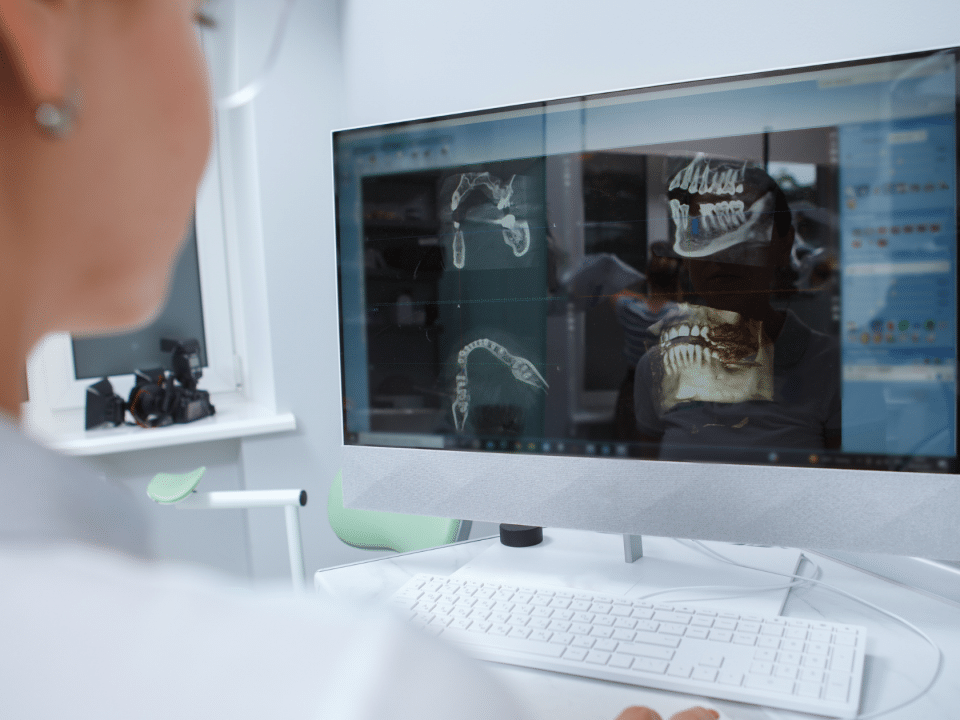 CBCT