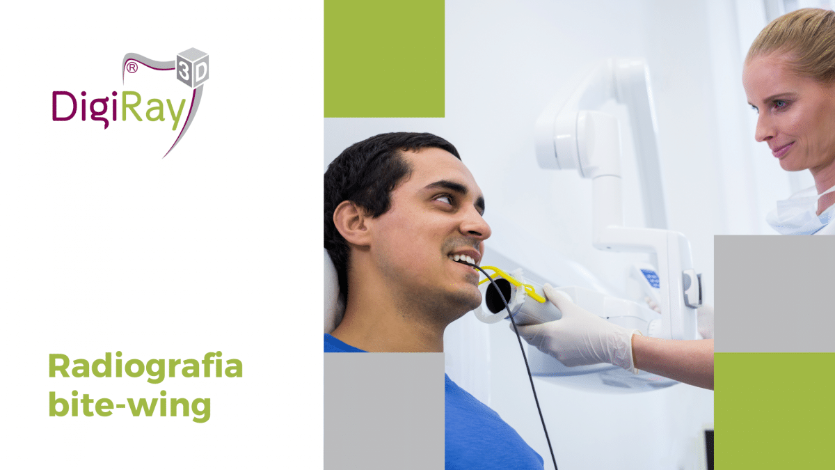 radiografia bite-wing
