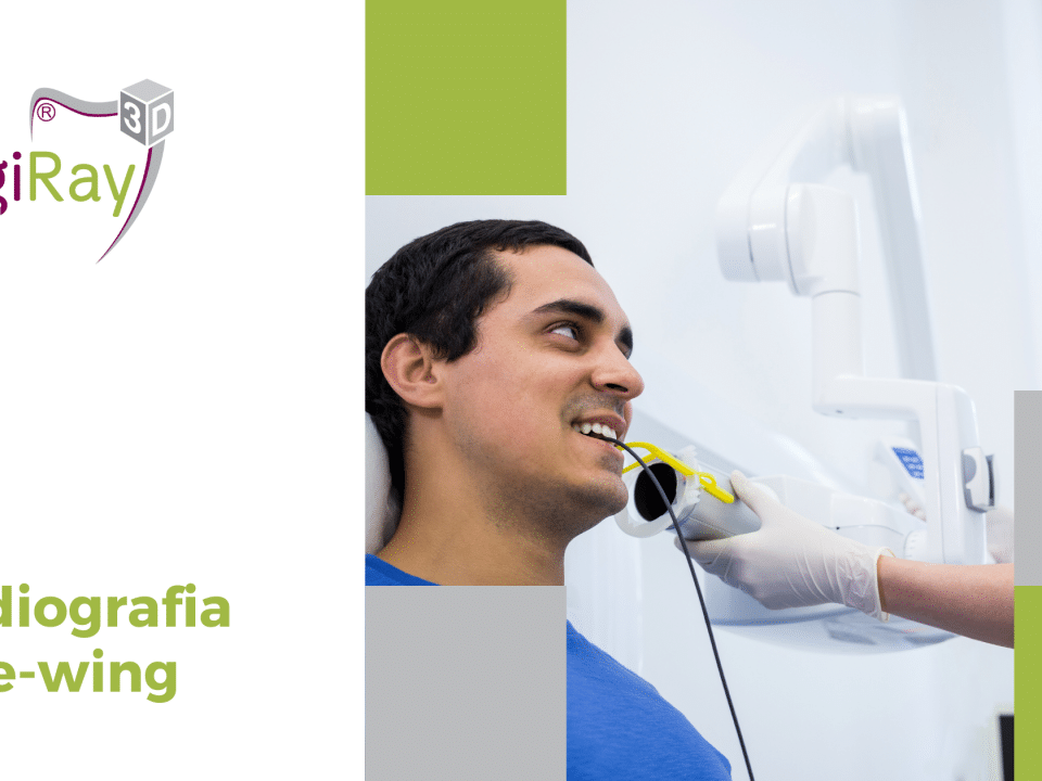 radiografia bite-wing