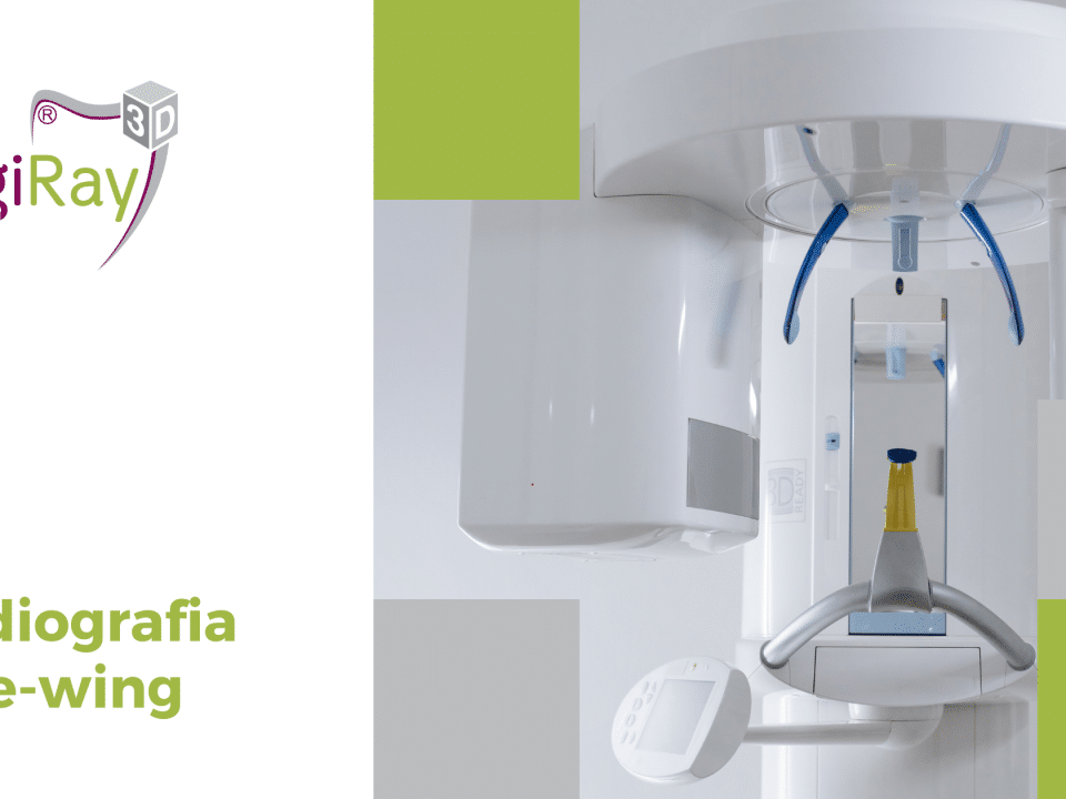radiografia bite-wing
