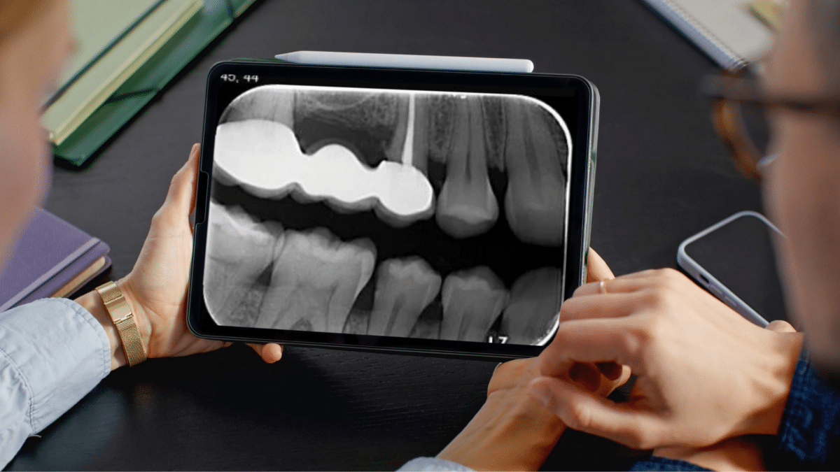 Radiografii intraorale