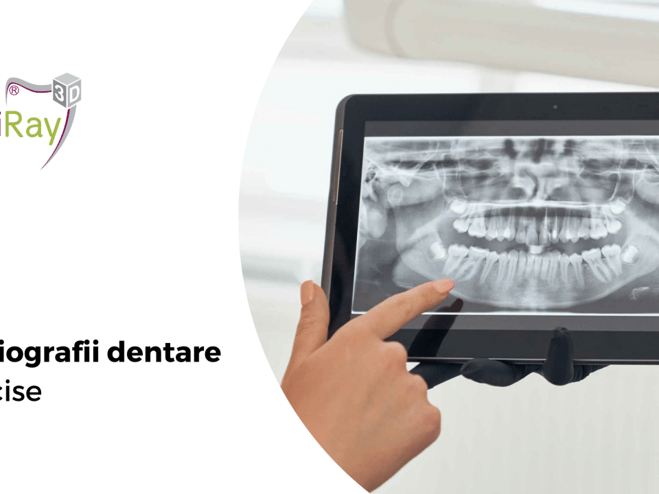 radiografii dentare