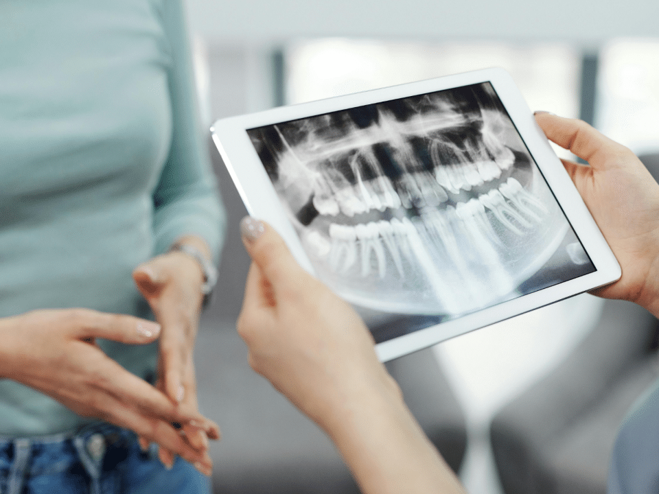 radiografii dentare