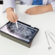 set ortodontic complet la DigiRay