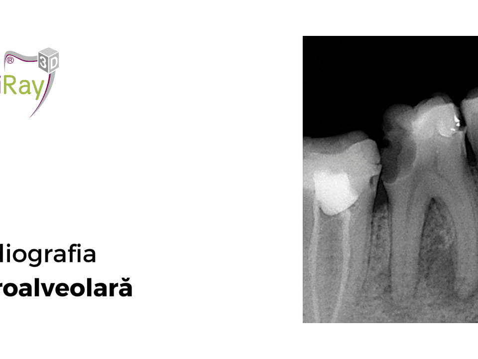 radiografia retroalveolară