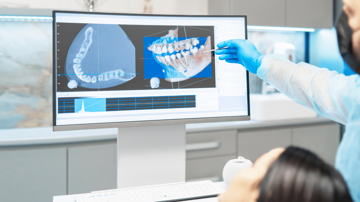 CBCT
