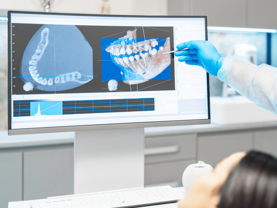 CBCT