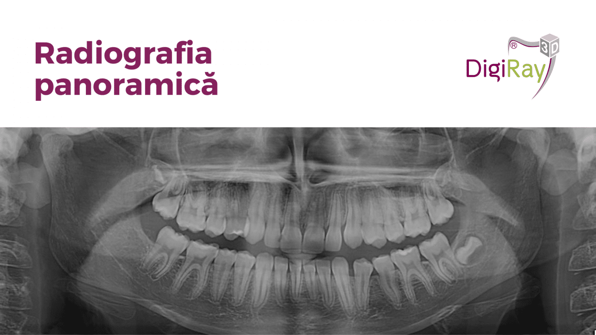 radiografia panoramică
