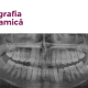 radiografia panoramică