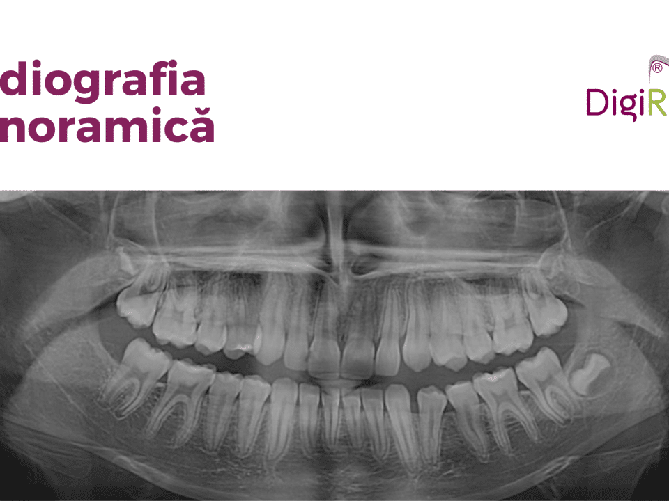 radiografia panoramică