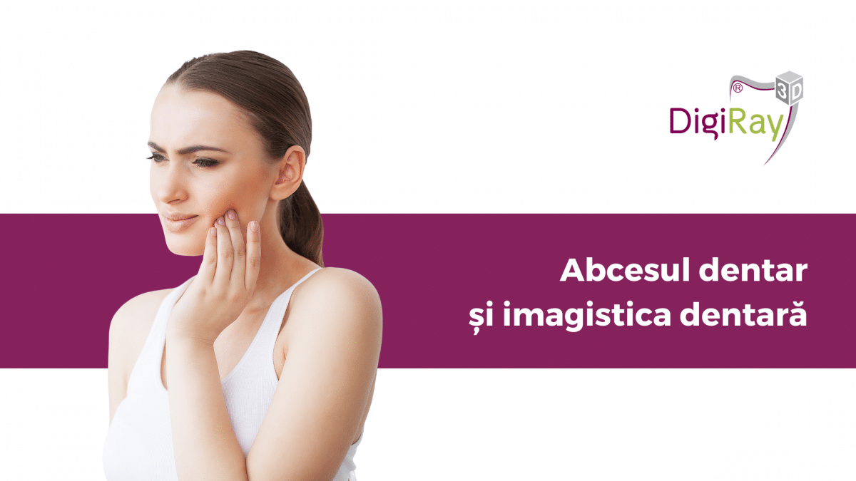 radiografie dentară pentru identificarea abcesului dentar
