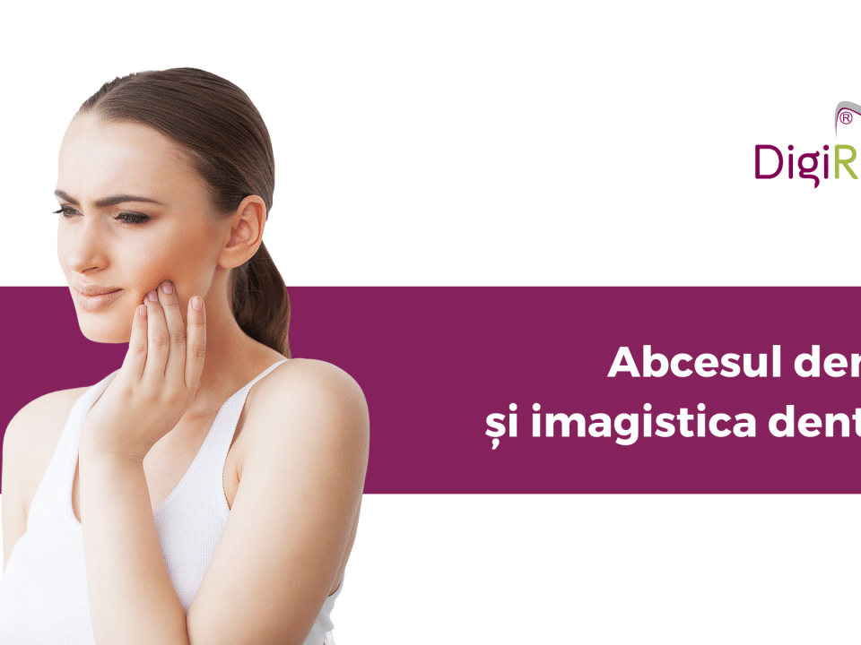 radiografie dentară pentru identificarea abcesului dentar