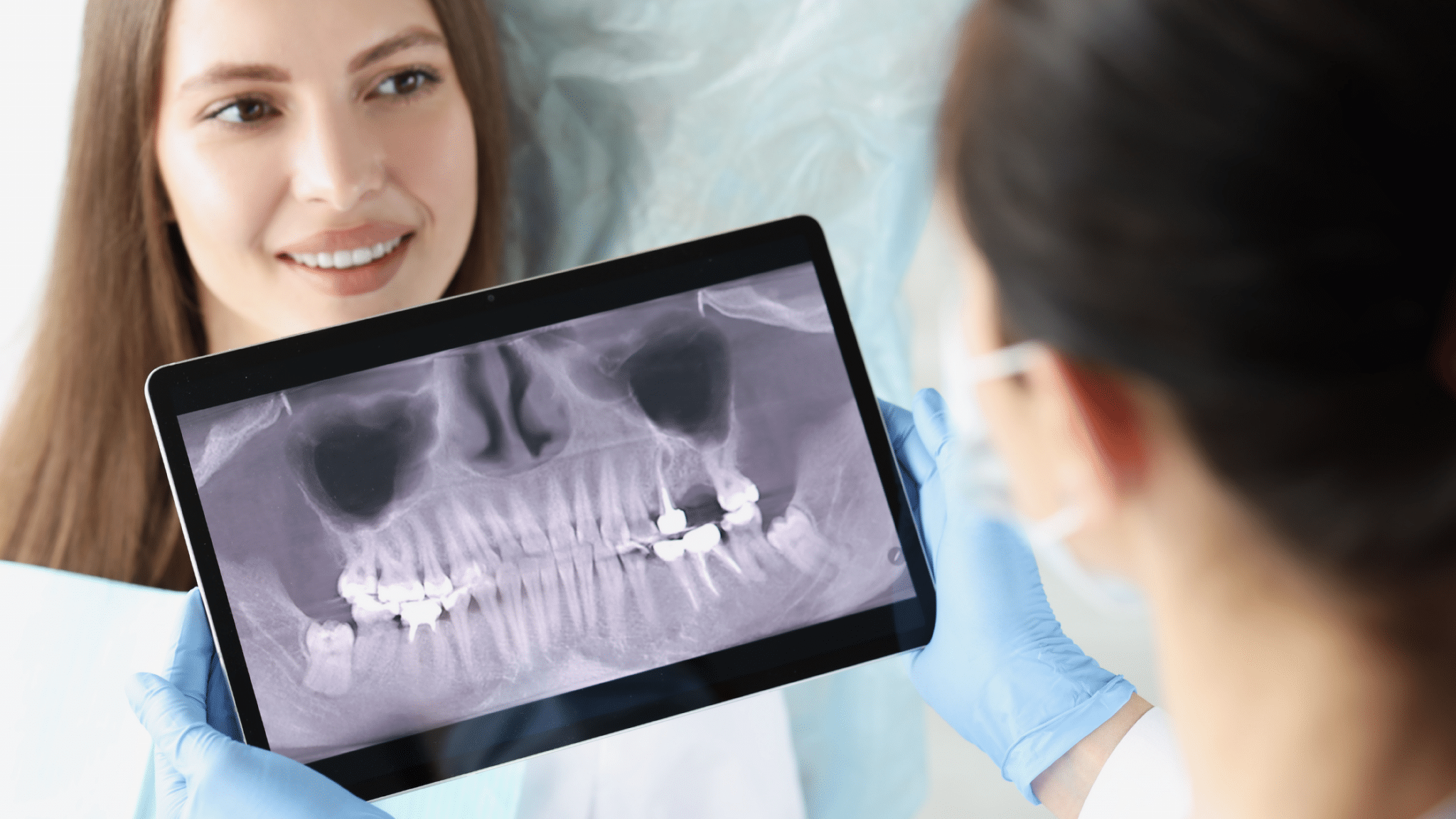radiografie dentară
