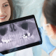 radiografie dentară