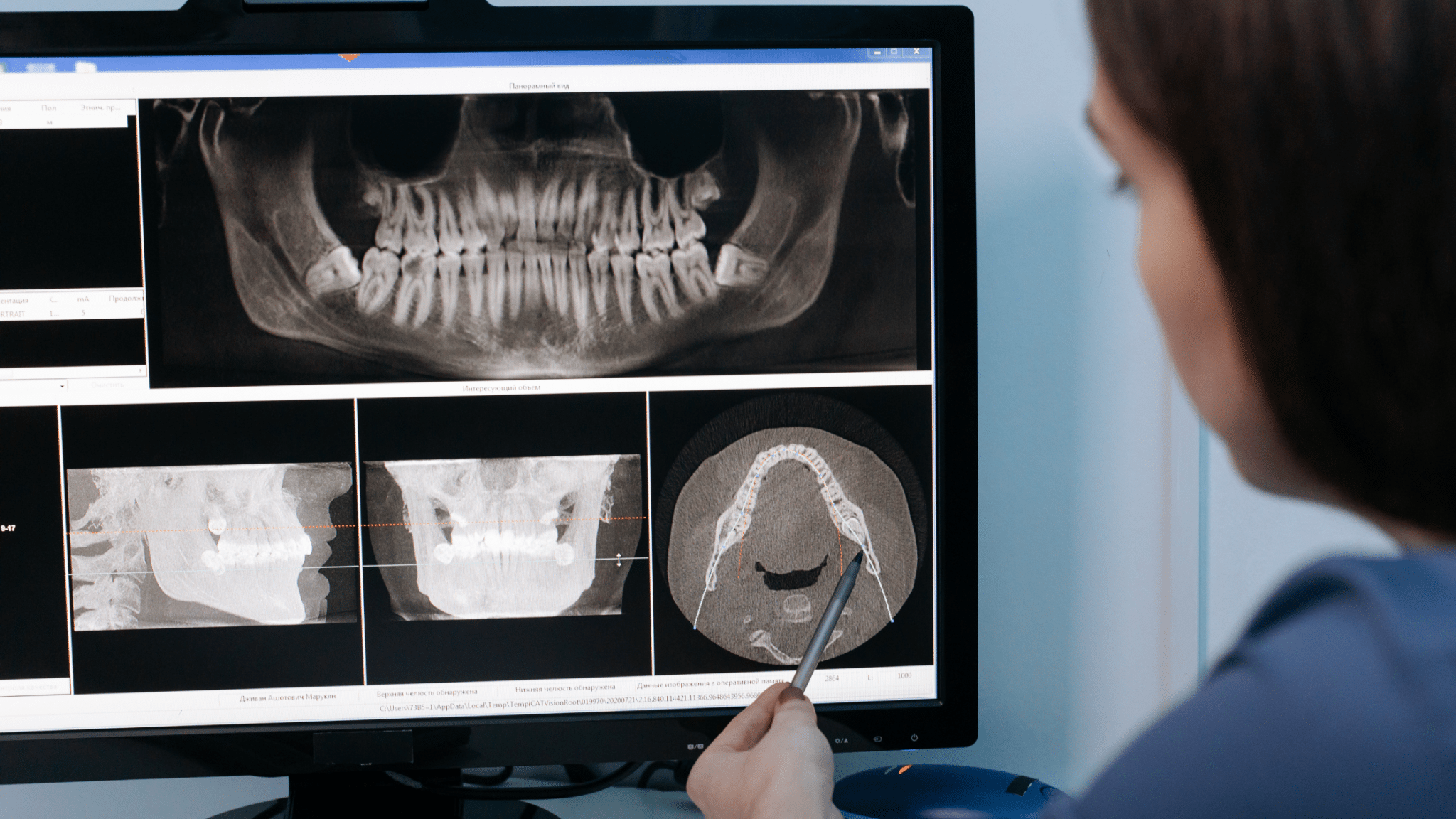 radiografie dentară