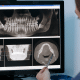 radiografie dentară