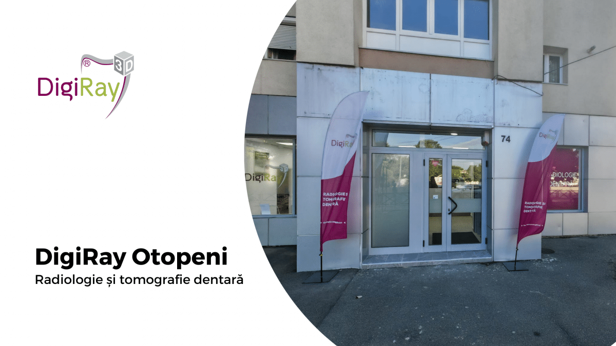 DigiRay Otopeni