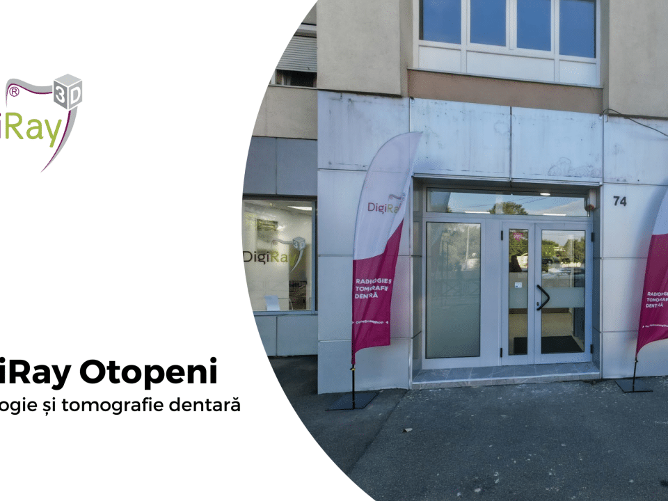DigiRay Otopeni