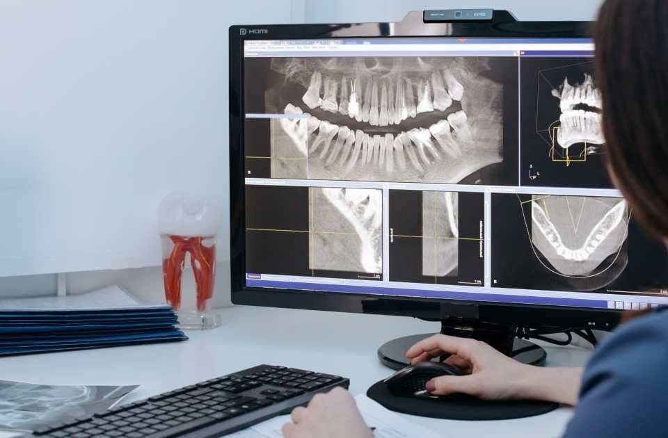 tomografie dentară la DigiRay