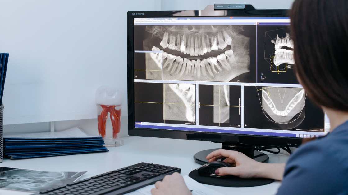 tomografie dentară la DigiRay