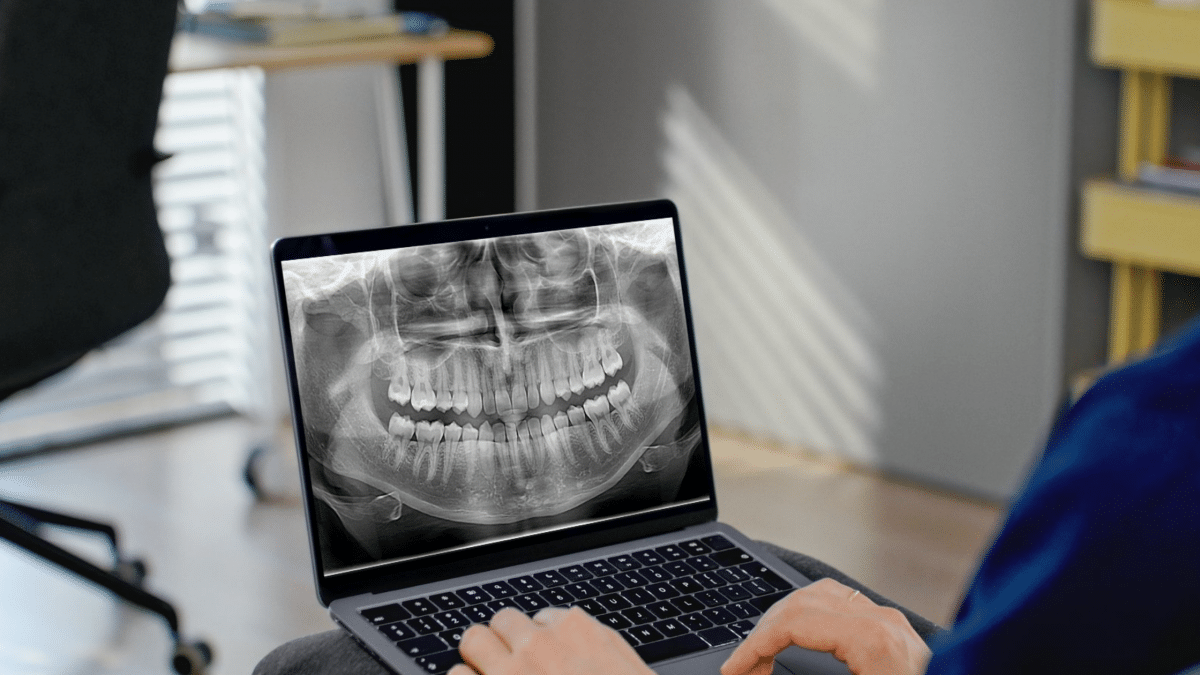 radiografii dentare
