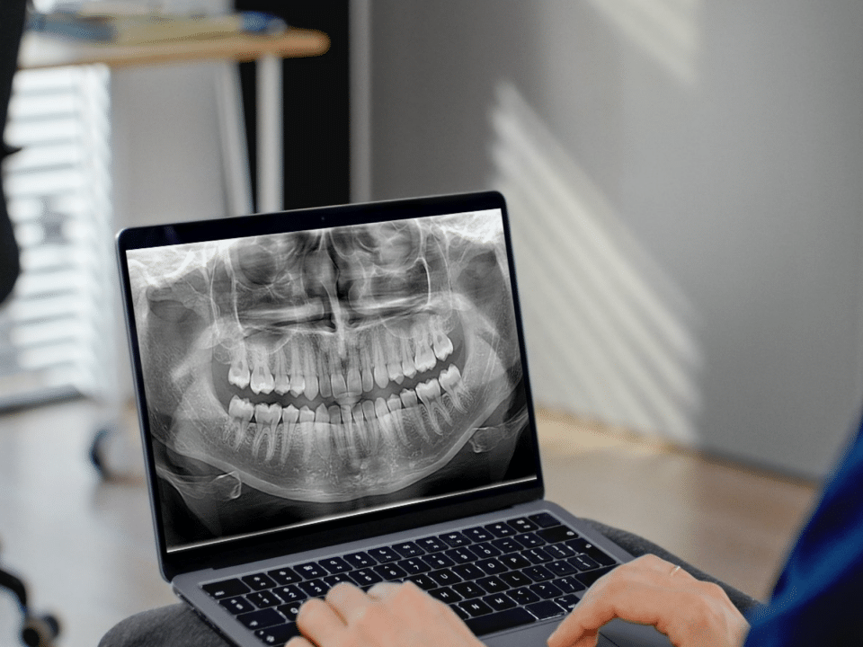 radiografii dentare