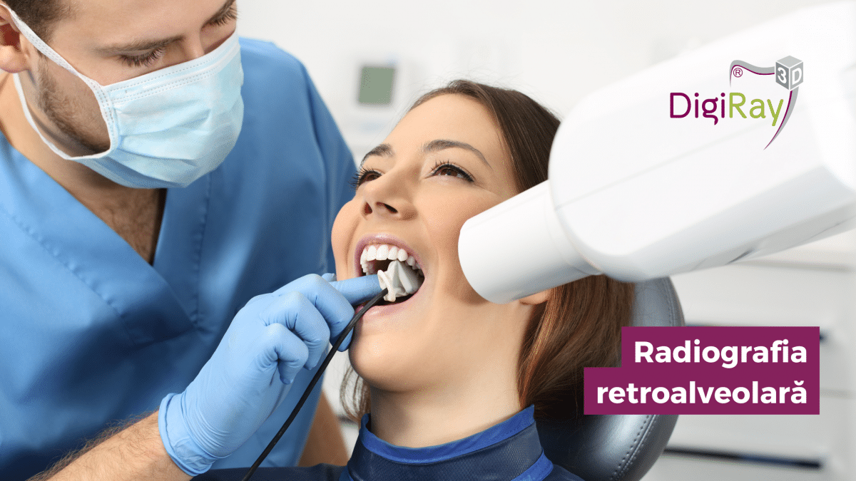 radiografie retroalveolară