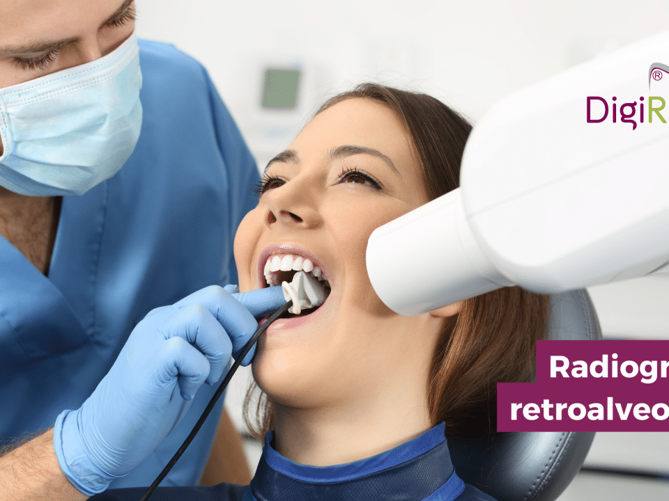 radiografie retroalveolară