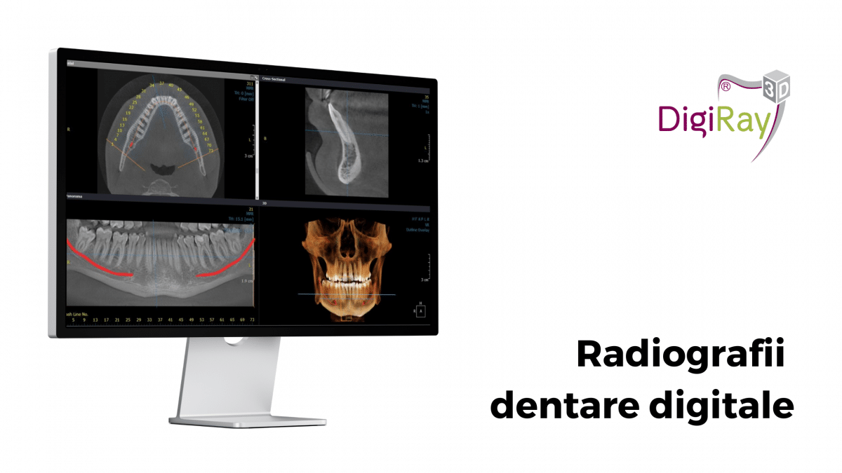 Radiografii dentare