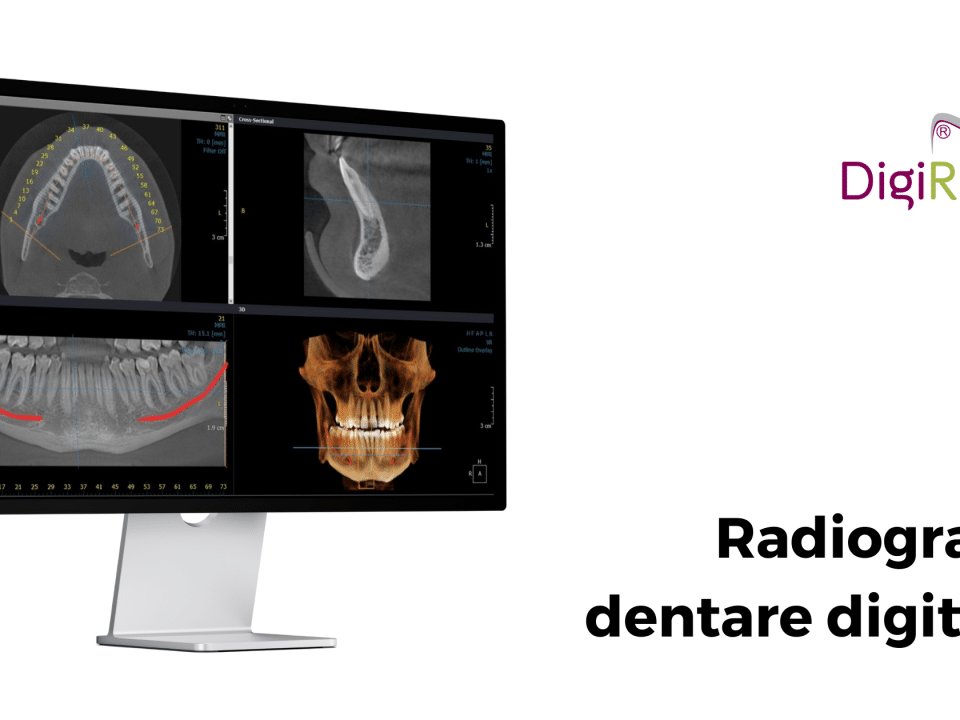 Radiografii dentare