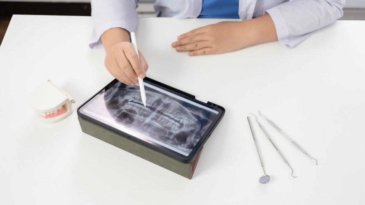 radiografia panoramică