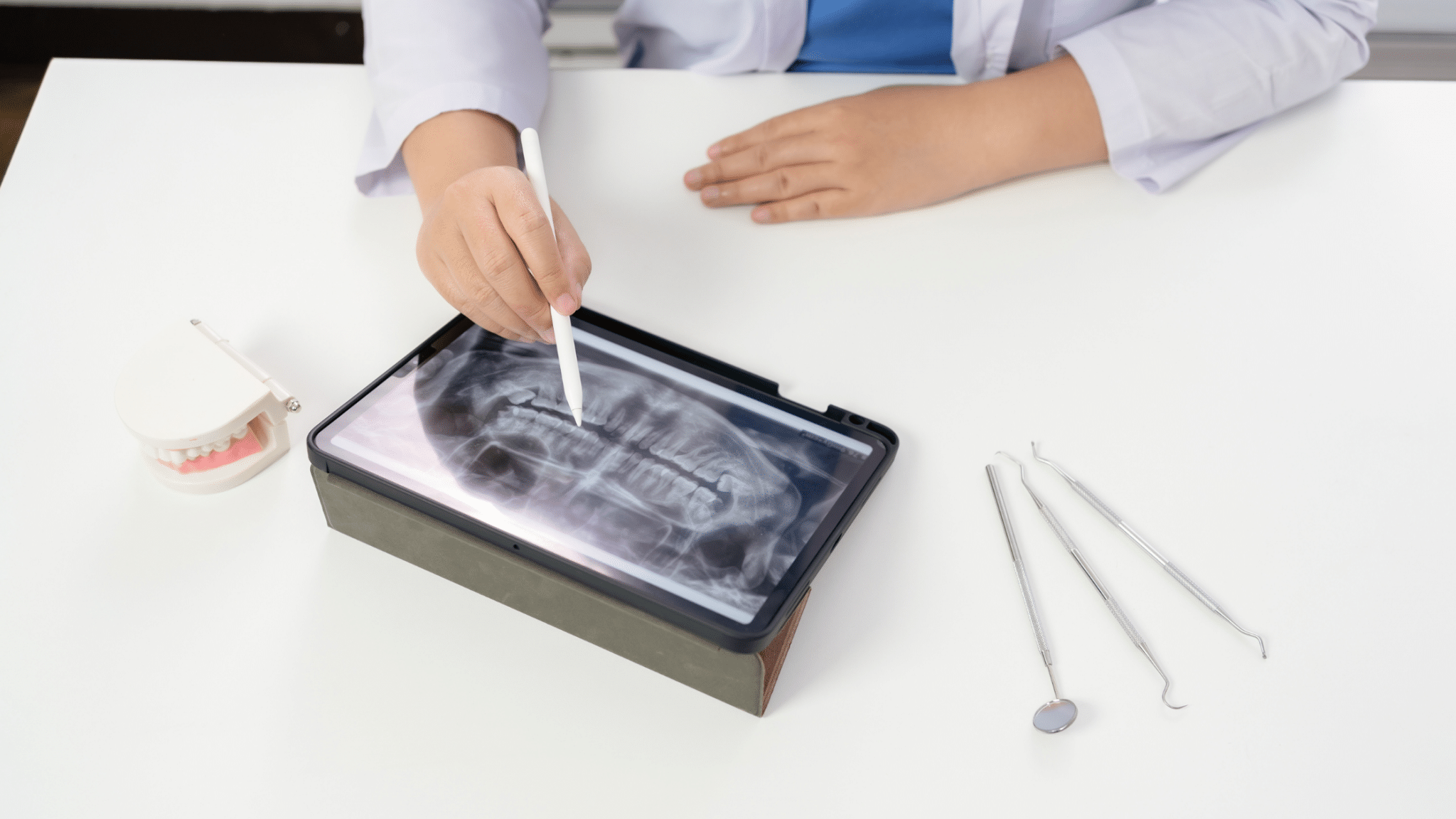 radiografia panoramică