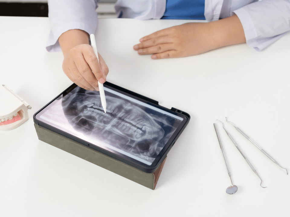 radiografia panoramică