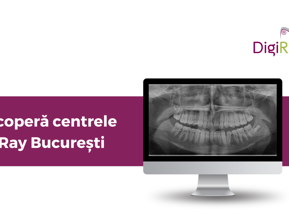 DigiRay Bucuresti
