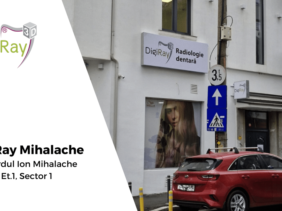 DigiRay Mihalache