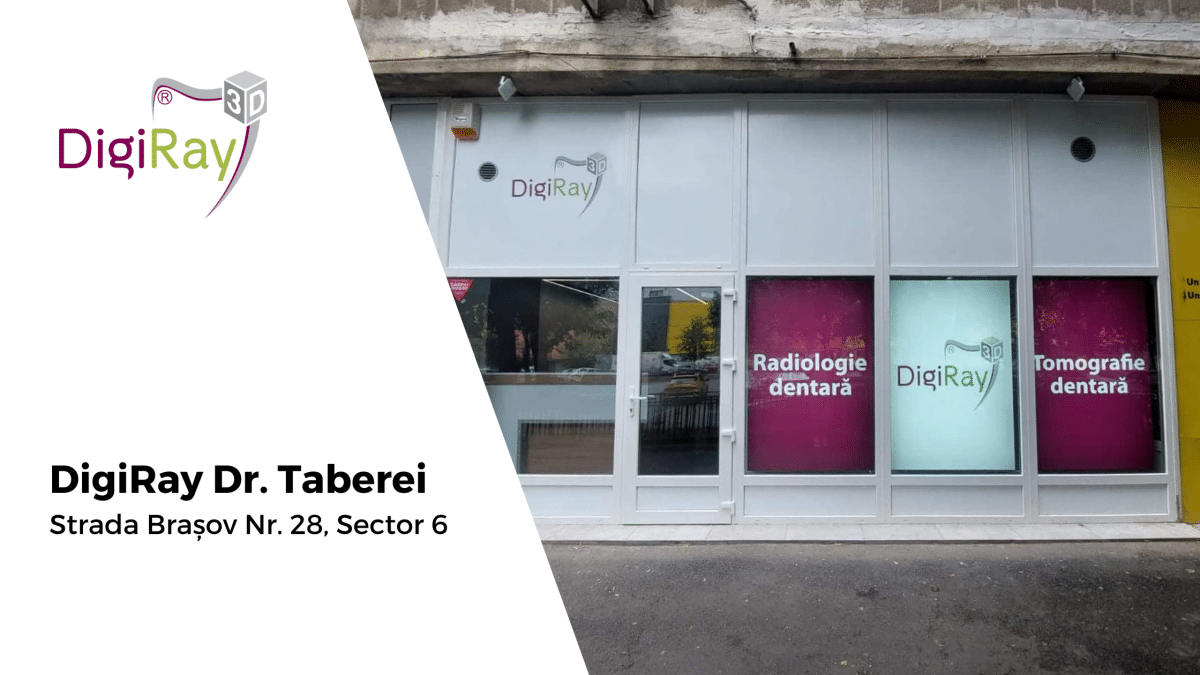 DigiRay Drumul Taberei, radiologie dentara Bucuresti