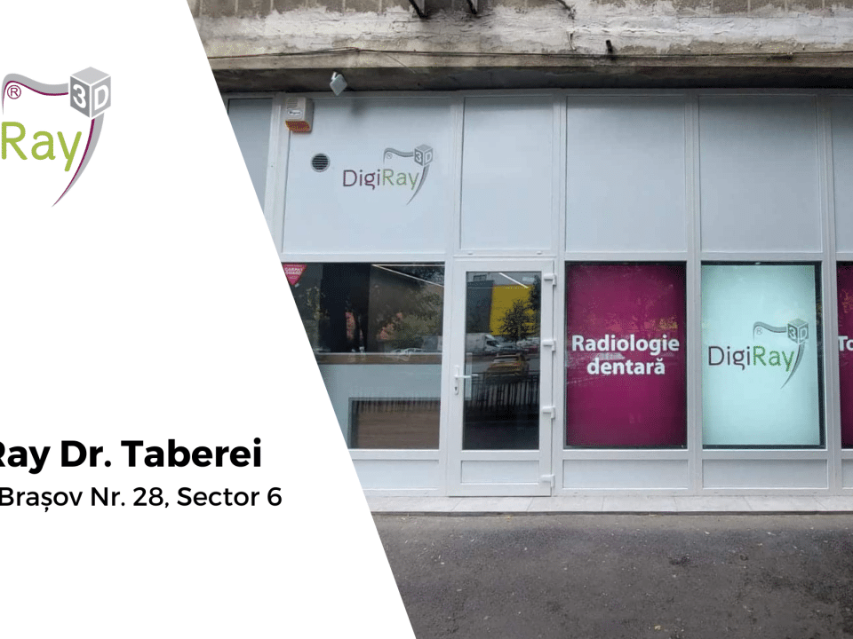 DigiRay Drumul Taberei, radiologie dentara Bucuresti