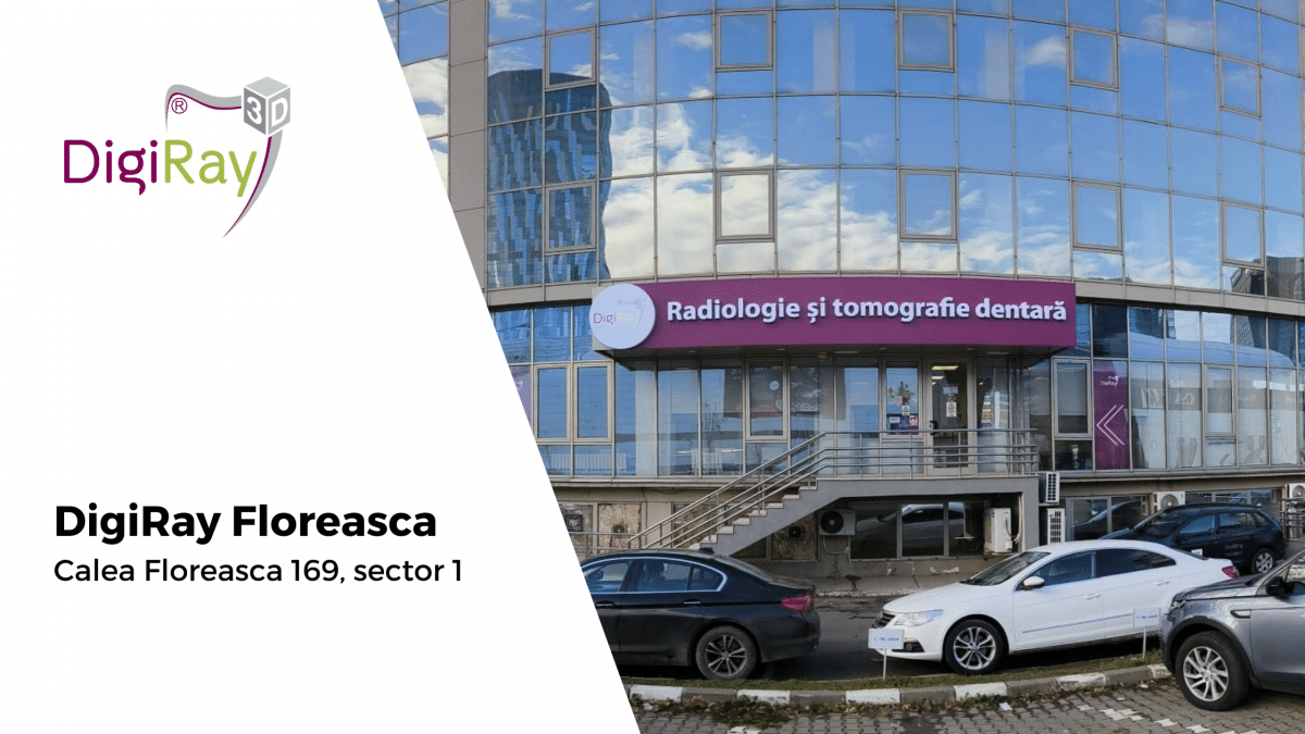 DigiRay Floreasca