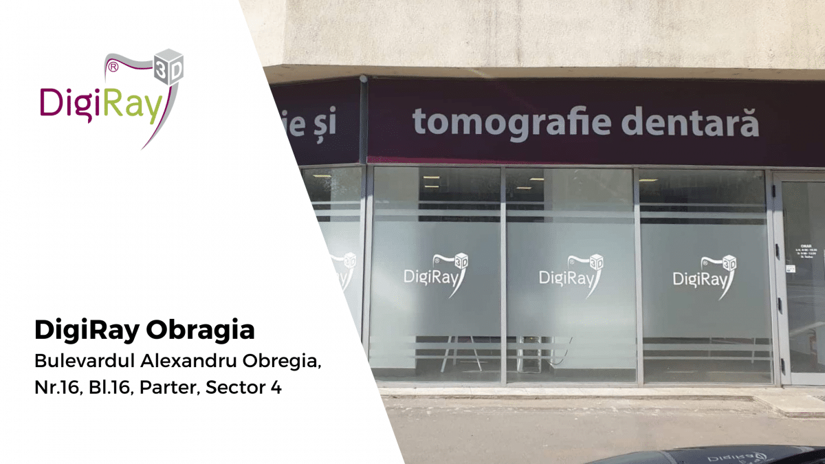 radiografie dentară Obregia