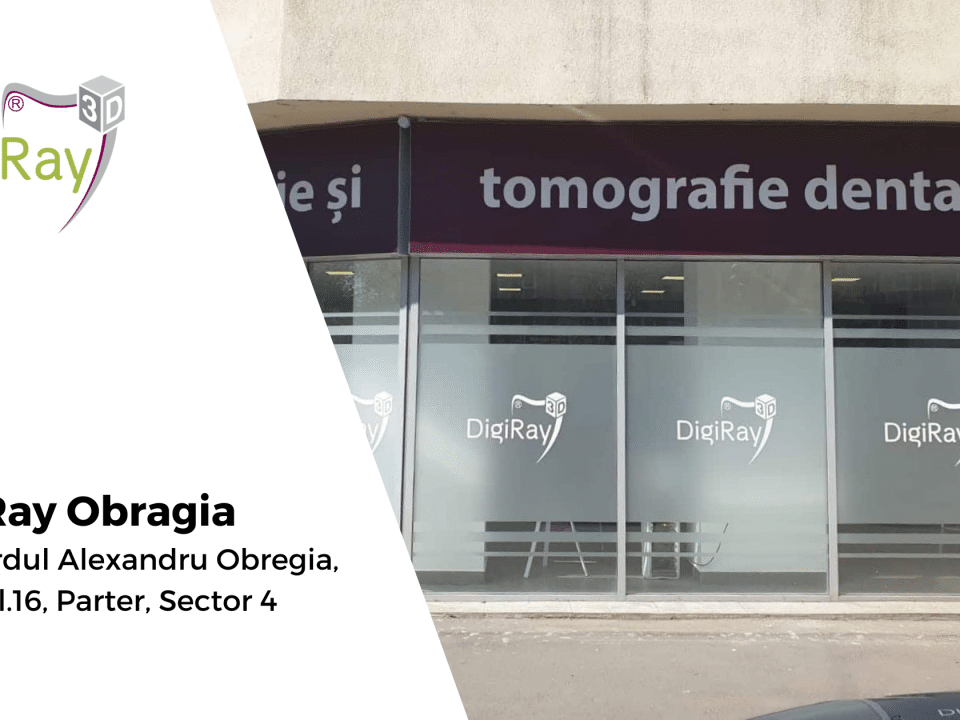 radiografie dentară Obregia